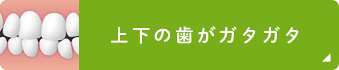 上下の歯がガタガタ