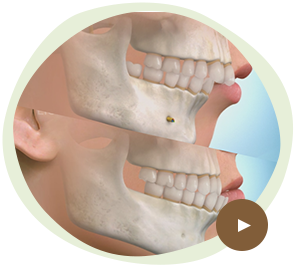 顔の骨格から整える外科矯正にも対応